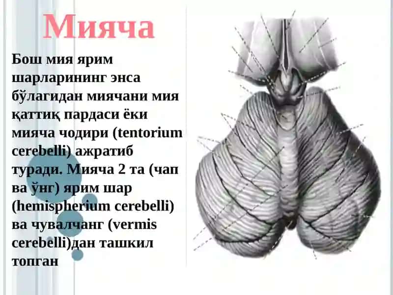 Мияча 3
