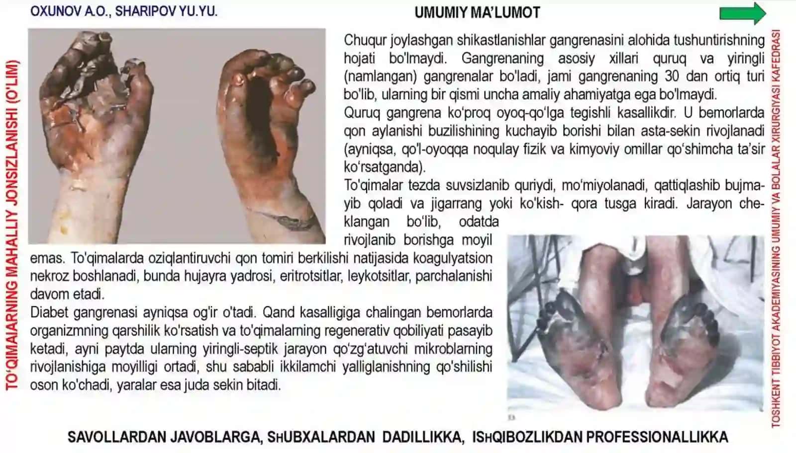 Qon Tomirlar Obliteratsiyalanuvchi Kasalliklari 3