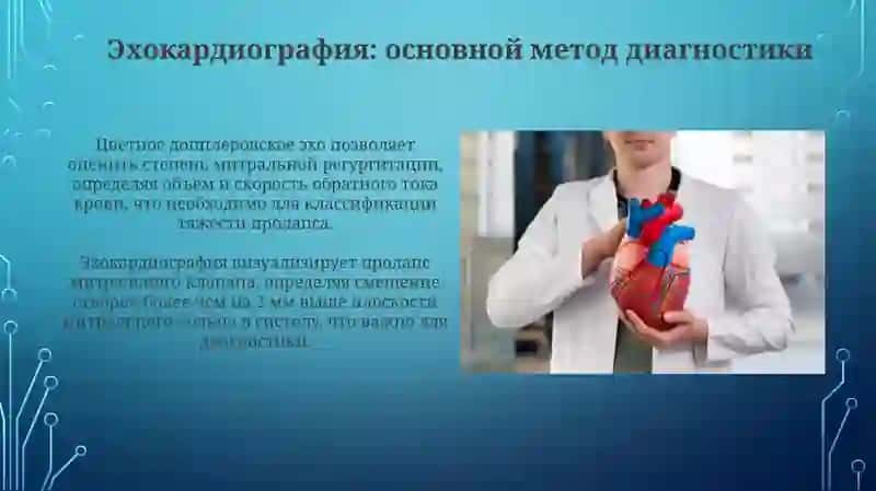 Пролапс митрального клапана 3