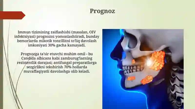 Mikozli anginalar 3