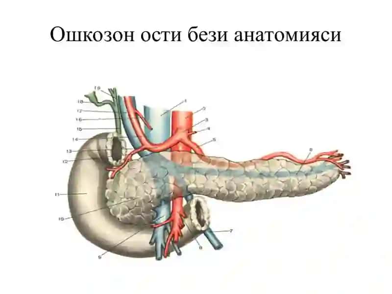 Уткир панкреатит 3