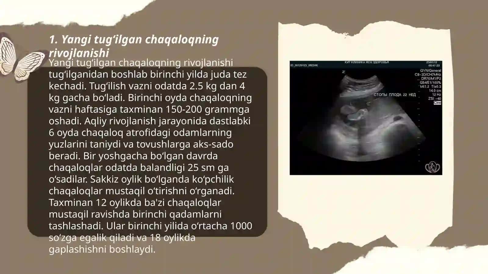 Yangi tug‘ilgan chaqaloqning rivojlanishi 3