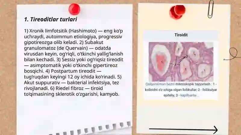 Tireoditlar 3