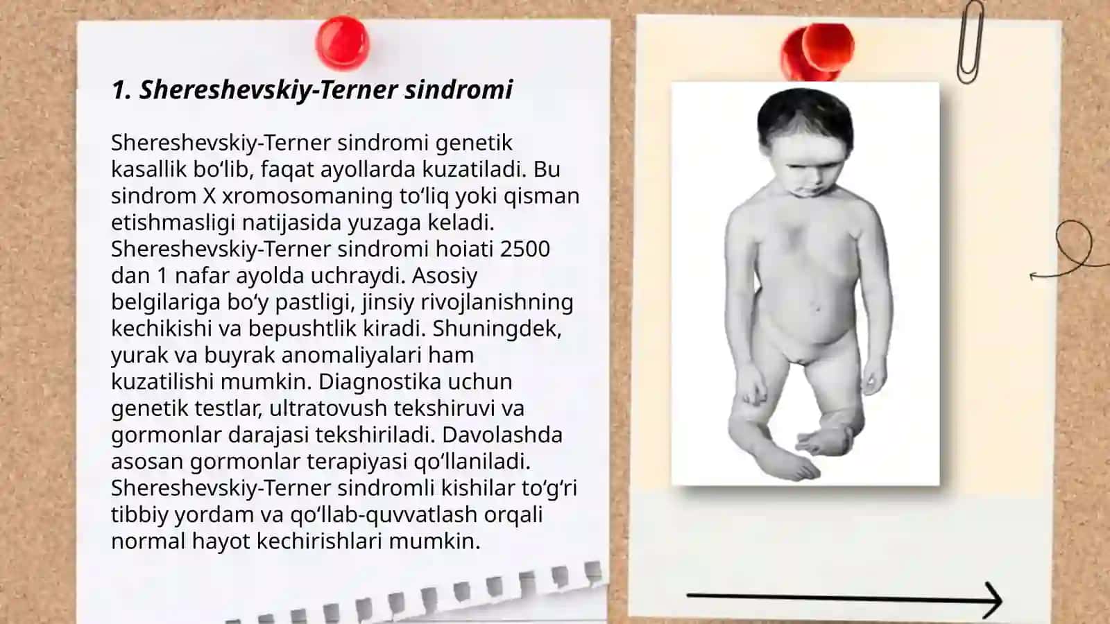 Shereshevskiy‐terner 3