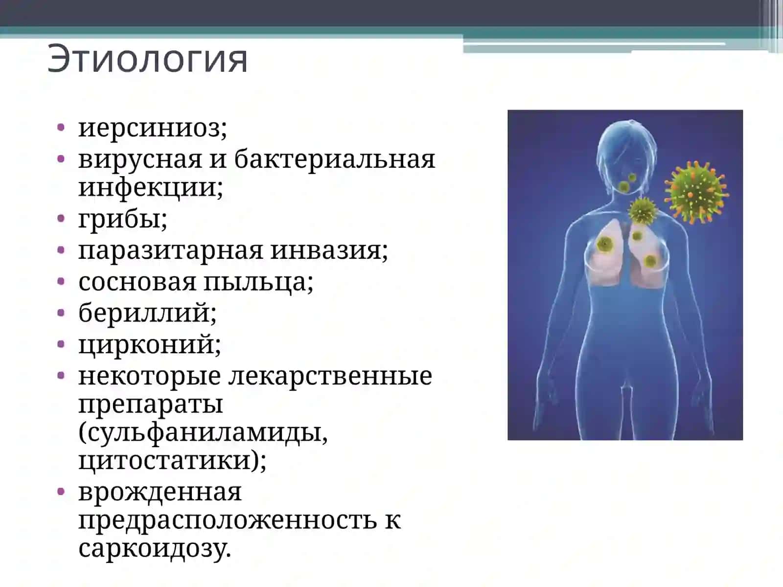 Саркоидоз легких (болезнь Бенье-Бека-Шауманна) 3