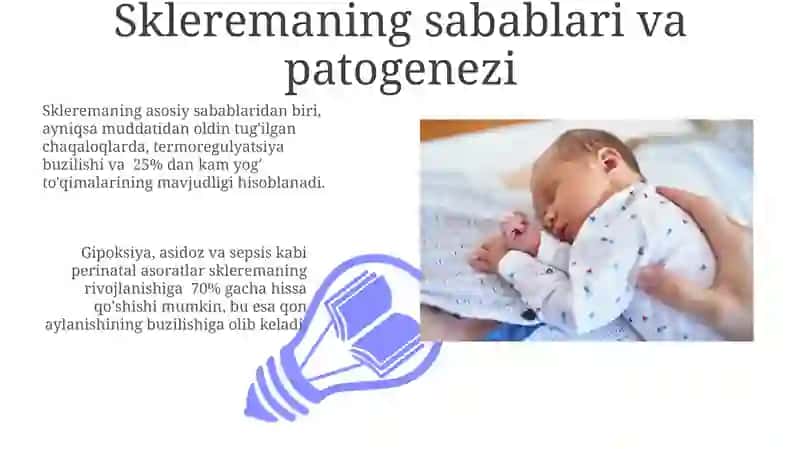 Yangi tug'ulgan chaqaloqlarda sklerema va skleredema 3