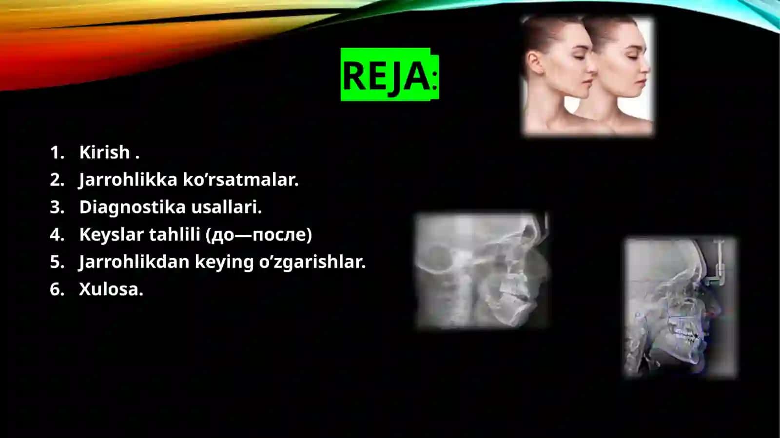 Ortognatik jarrohlik asoslari 3