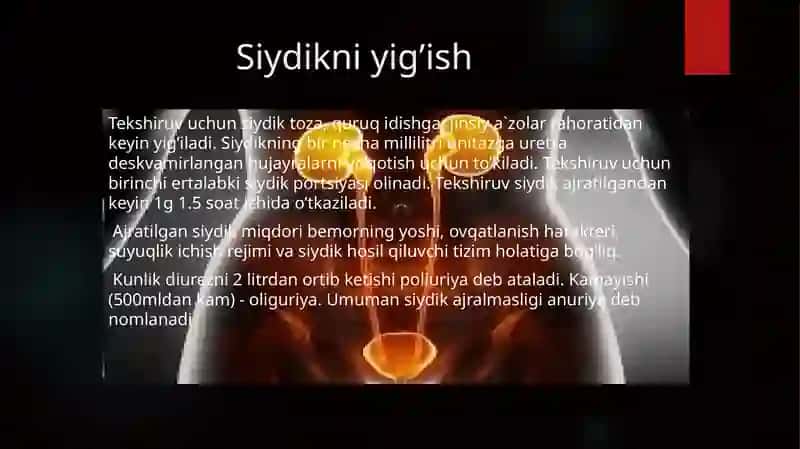 Siydik umumiy tahlili 3