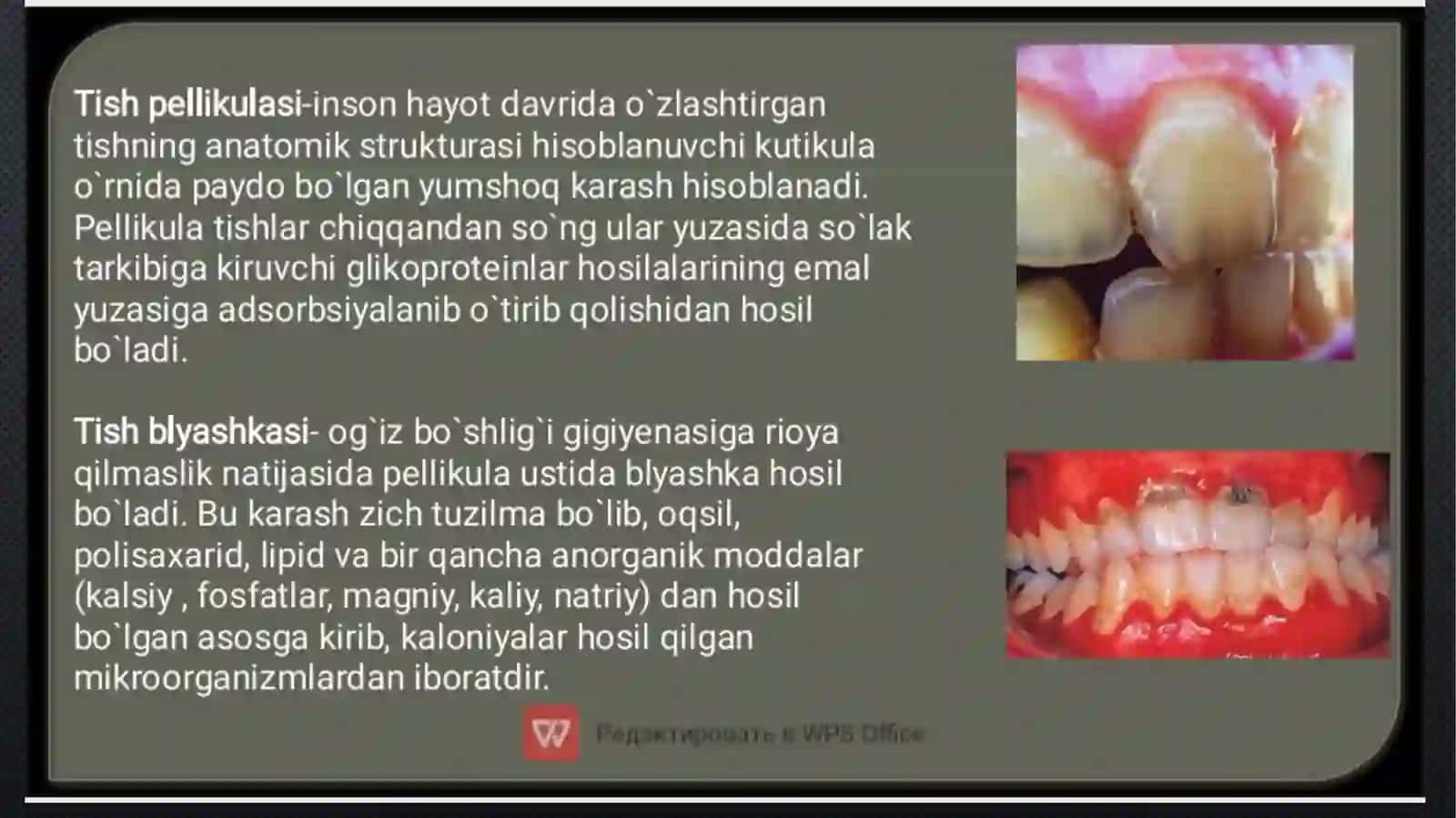 tish karashlarini tozalash usullari 3
