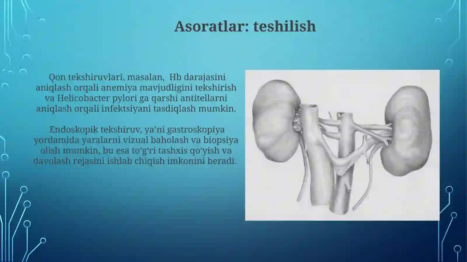 Oshqozon va oʻn ikki barmoqli ichak yara kasalligi asoratlari, diagnostikasi 3