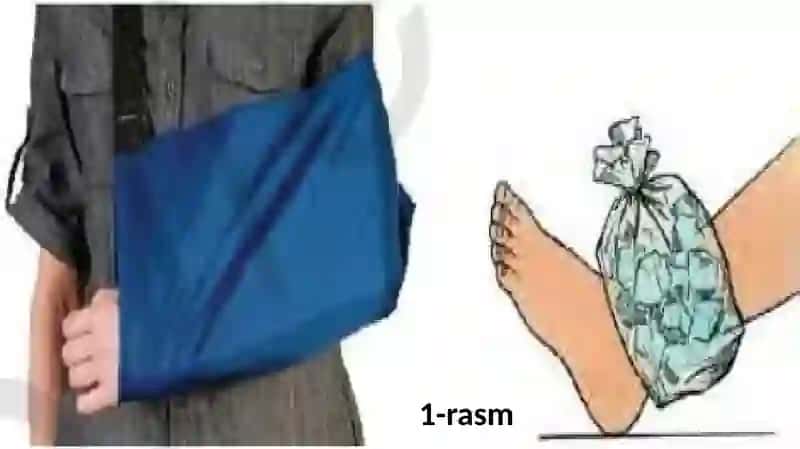 Suyaklar shikastlanganda birinchi yordam ko’rsatish 3