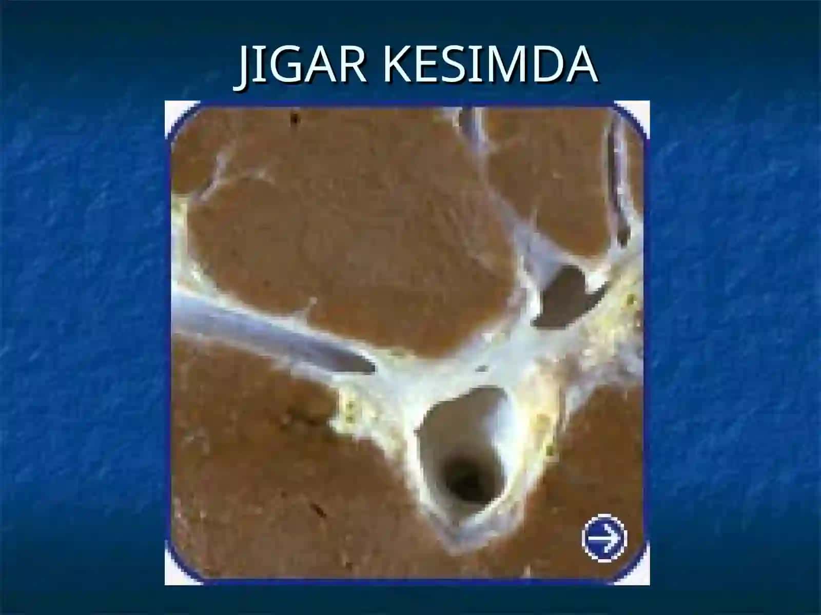 JIGARSIRROZI 3