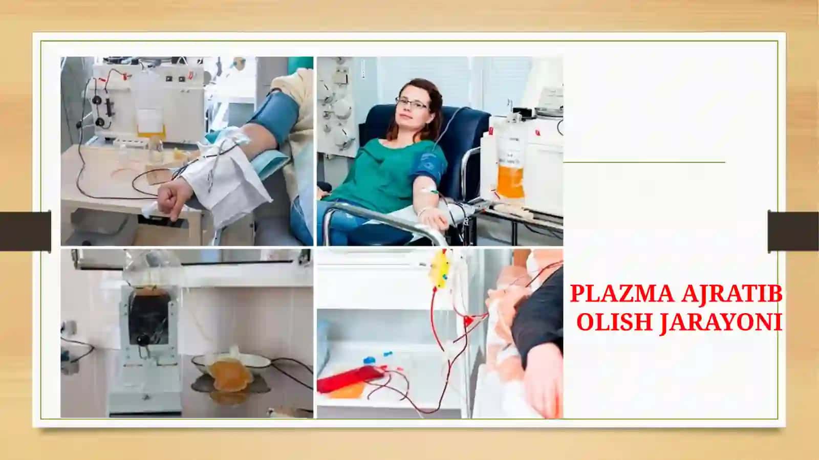 PLAZMOFEREZ 3