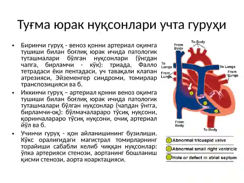Tug’mayurak nuqsonlari 3