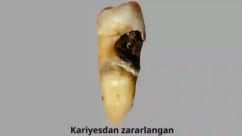 Kariyes 3