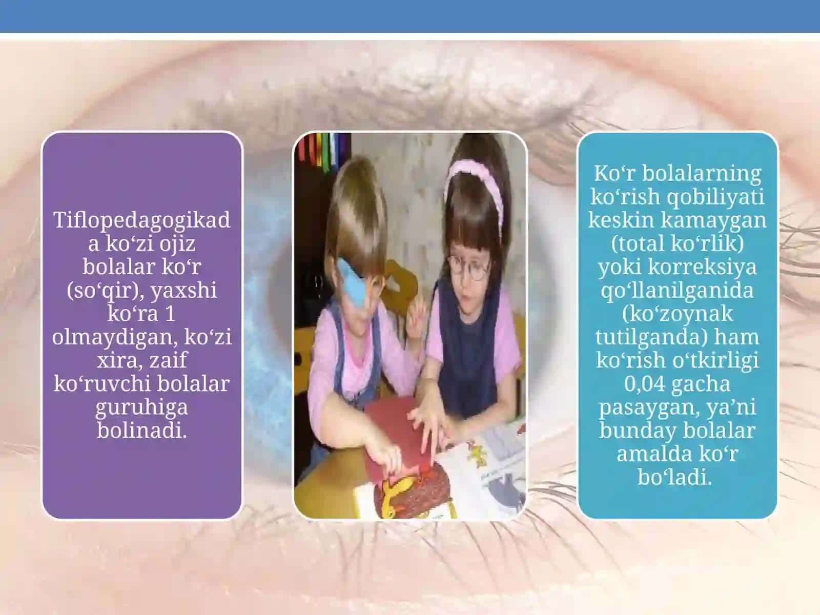 Korishda nuqsoni bor bolalar 3
