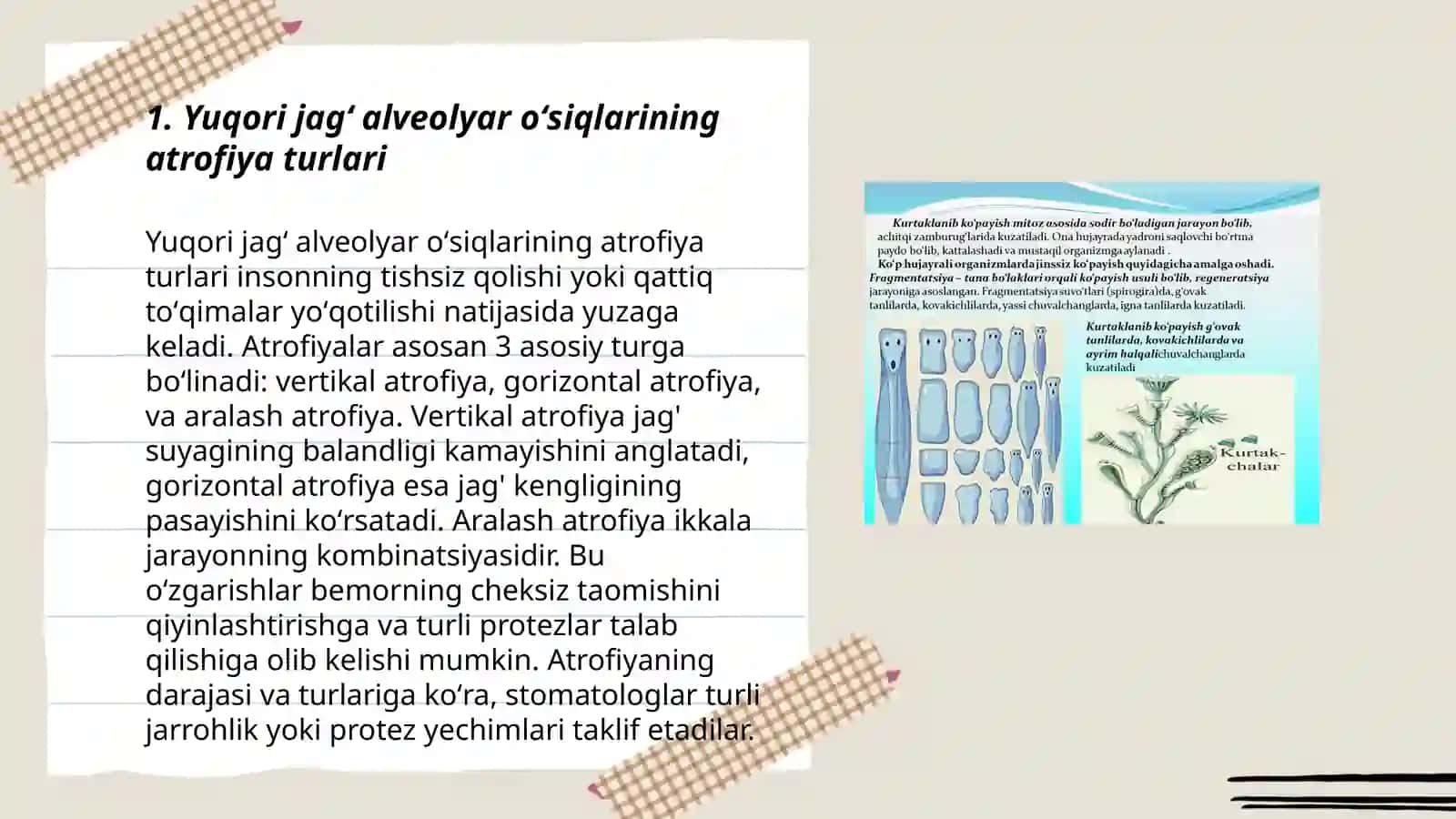 Yuqori va pastki jagʻ alveolyar oʻsiqlari atrofiyasining klassifikatsiyasi va atrofiyani bartaraf etish usullari 3