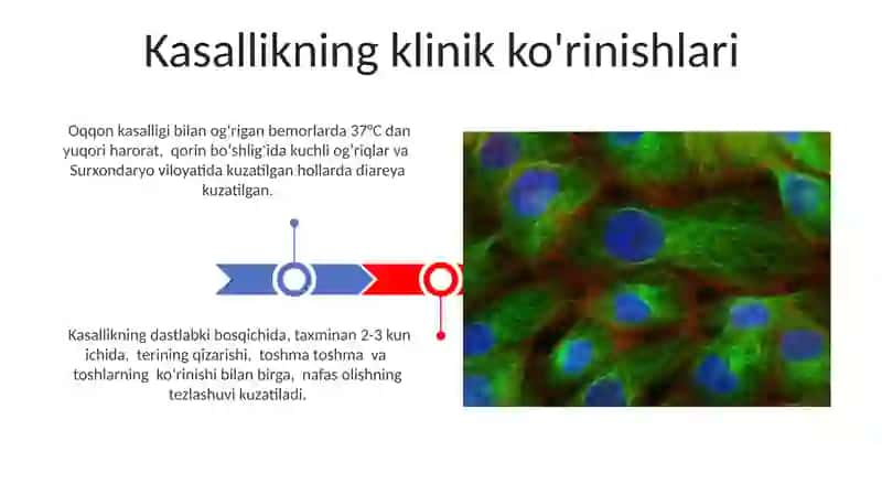 Oqqon kasalligi: Tashxisi va klinik ko'rinishlari 3