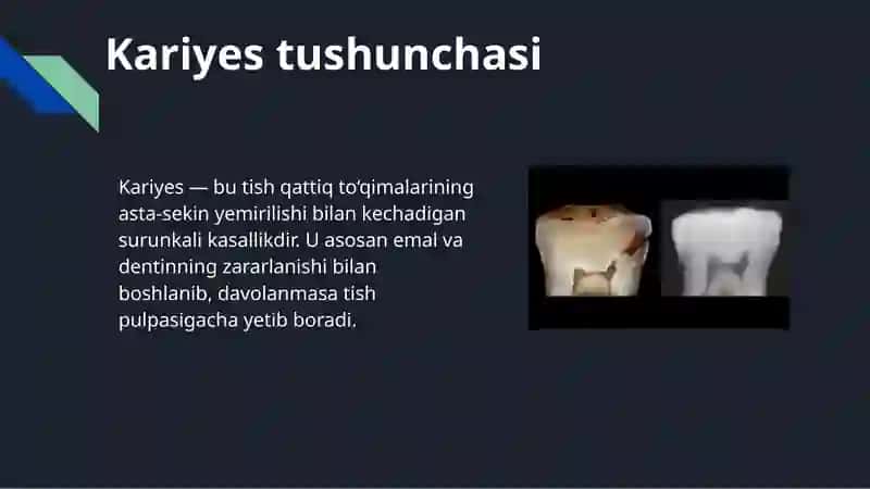 Kariyes haqida tushuncha. Ushbu mavzuda tish kariyesining kelib chiqish sabablari, rivojlanish bosqichlari, klinik belgilari, asoratlari, davolash usullari va oldini olish choralari keng yoritiladi. 3