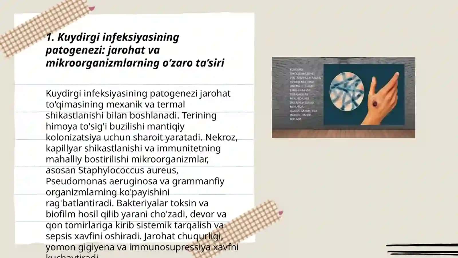 Kuydirgi infeksiyasida teri zararlanishini patogenezi,klinik manzarasi,tashxislanishi,umumiy va mahalliy davolash va oldini olish qoidalari 3