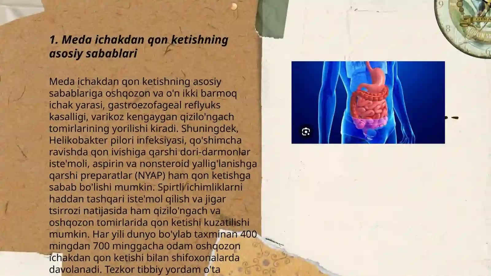 Meda ichakdan qon ketishda kechiktirib bólmaydigan holatlarda bemorlarga shoshilinch yordam kórsatish 3