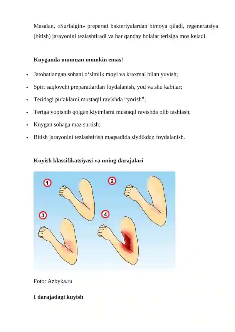 Kuyish - turlari, darajalari va birinchi yordam ko‘rsatish usullari 3