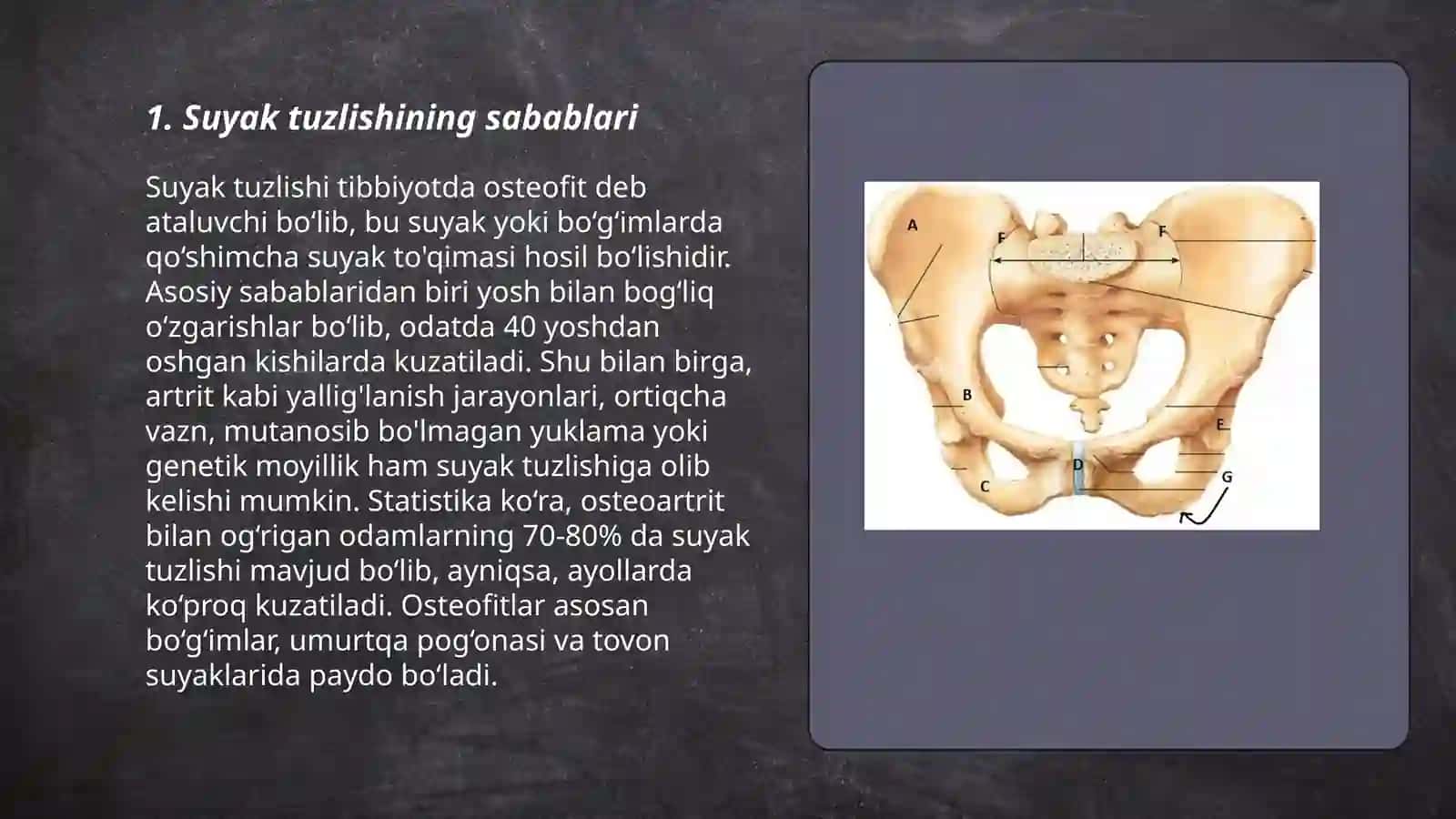 Suyak tuzlishi 3