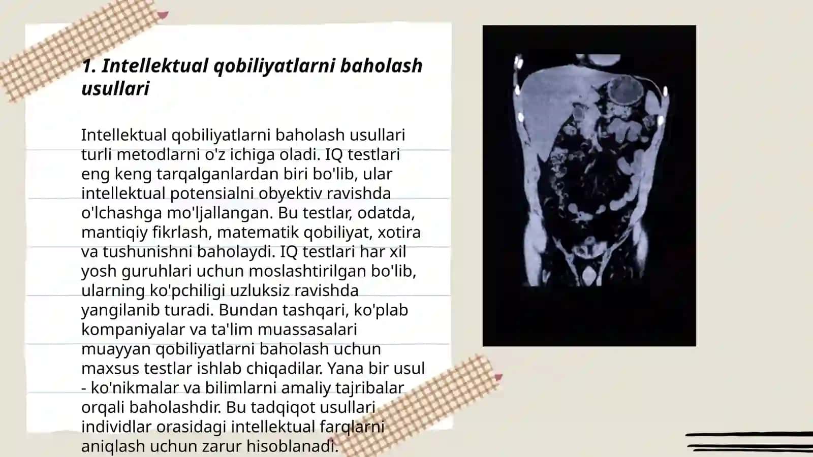 Intellektual qobiliyatlarni baholash usullari 3