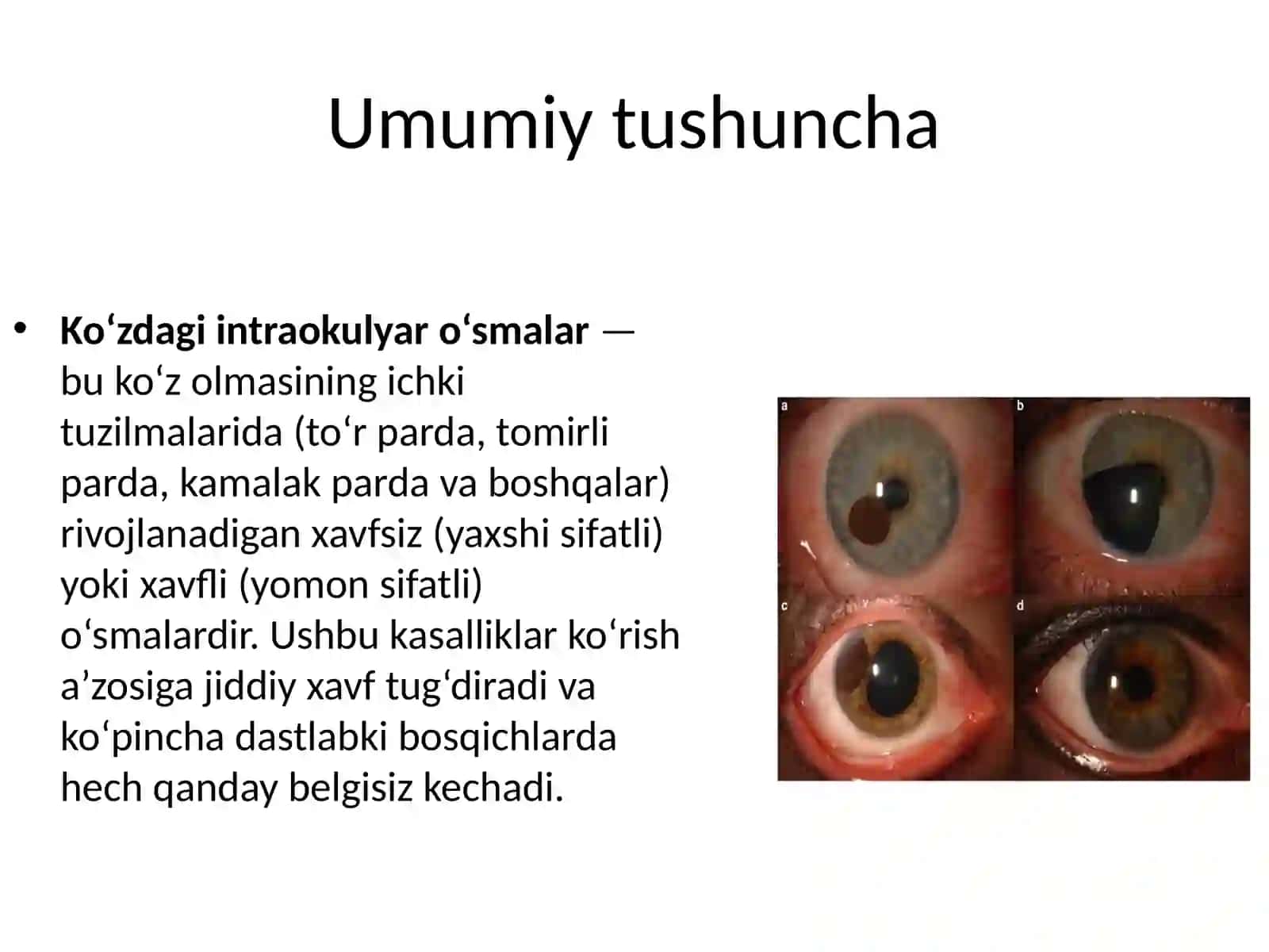 introkulyar o'smalar 3