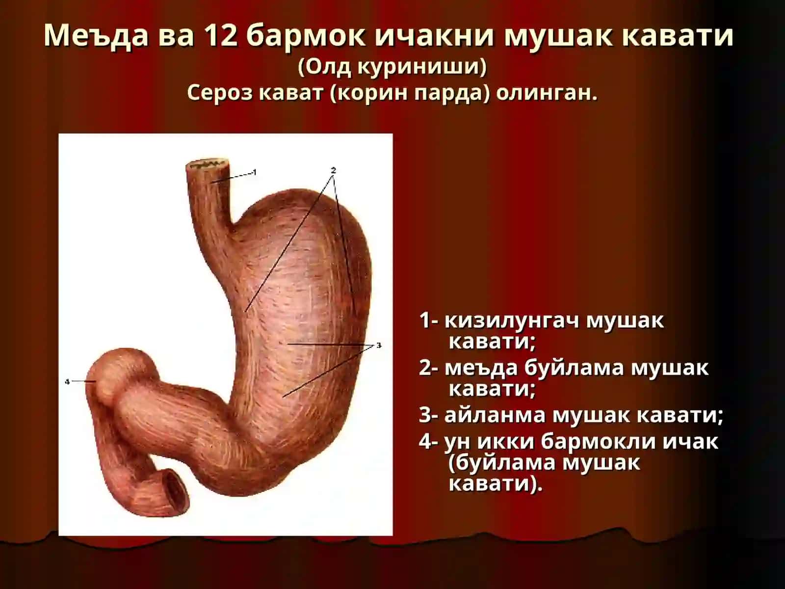 Меъда ва ун икки бармок ичак яра касаллиги 3