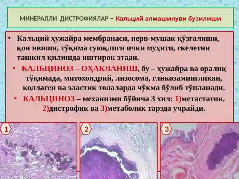 МИНЕРАЛЛИ ДИСТРОФИЯЛАР 3