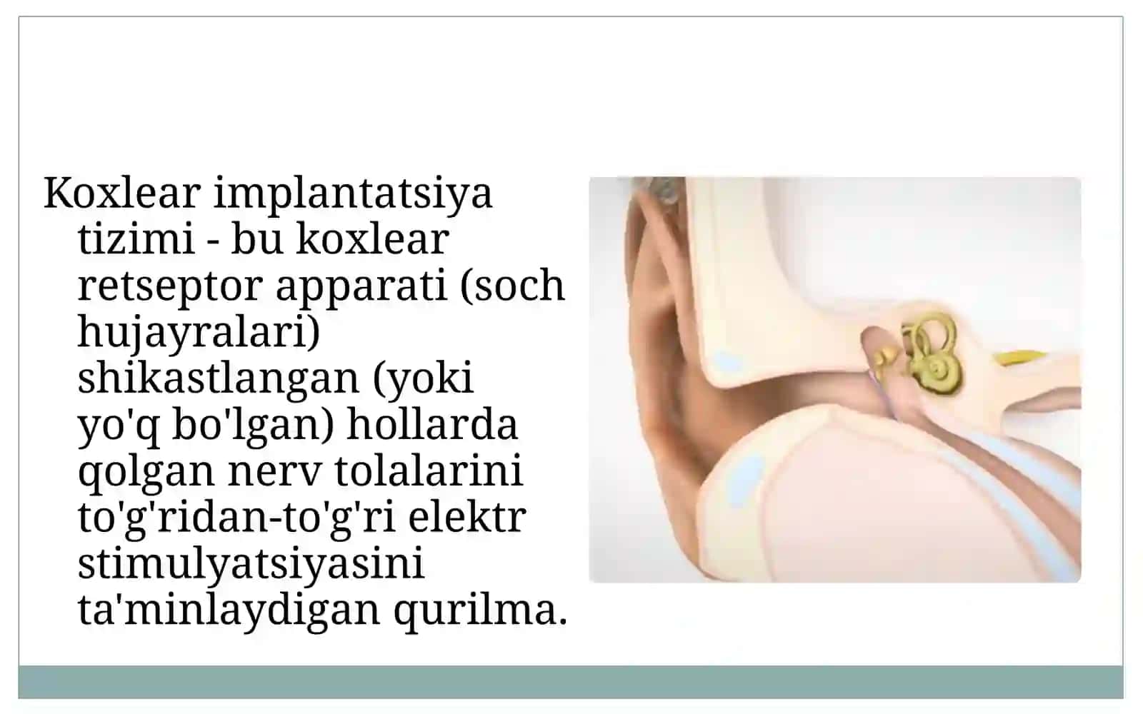 Koxlearimplant va uning xususiyatlari 3