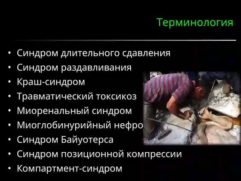Синдром длительного сдавления 3
