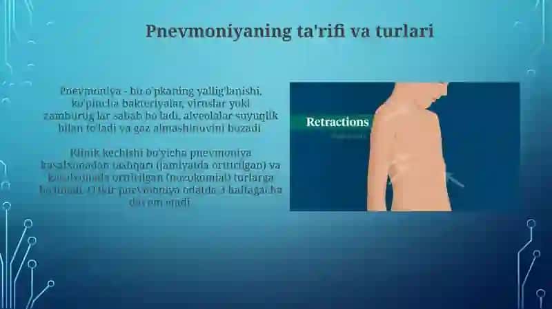 Pnevmoniya simtomatologiyasi, diagnostik kriteriyalari 3
