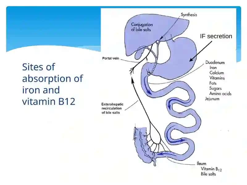 Anemia 3