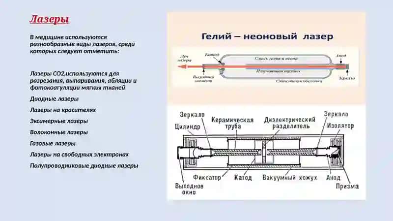 Лазеры в медицине 3