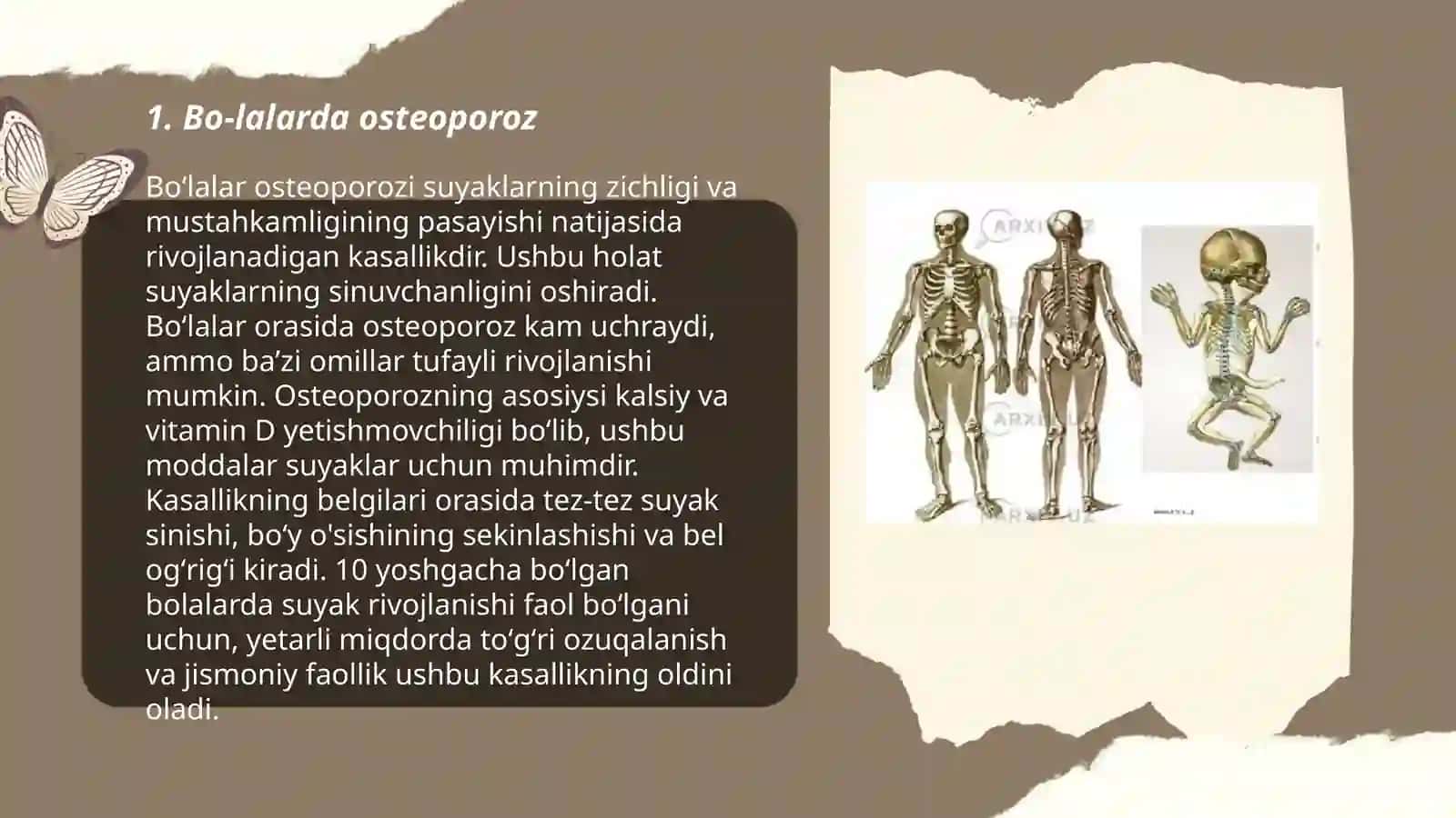 Bo-lalarda skelet patologiyasi 3