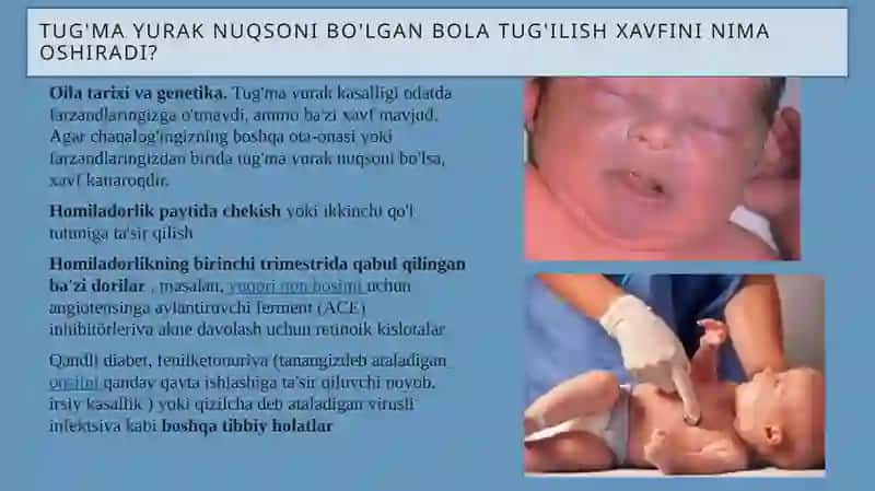 Yurakning tug'ma nuqsonlari 3