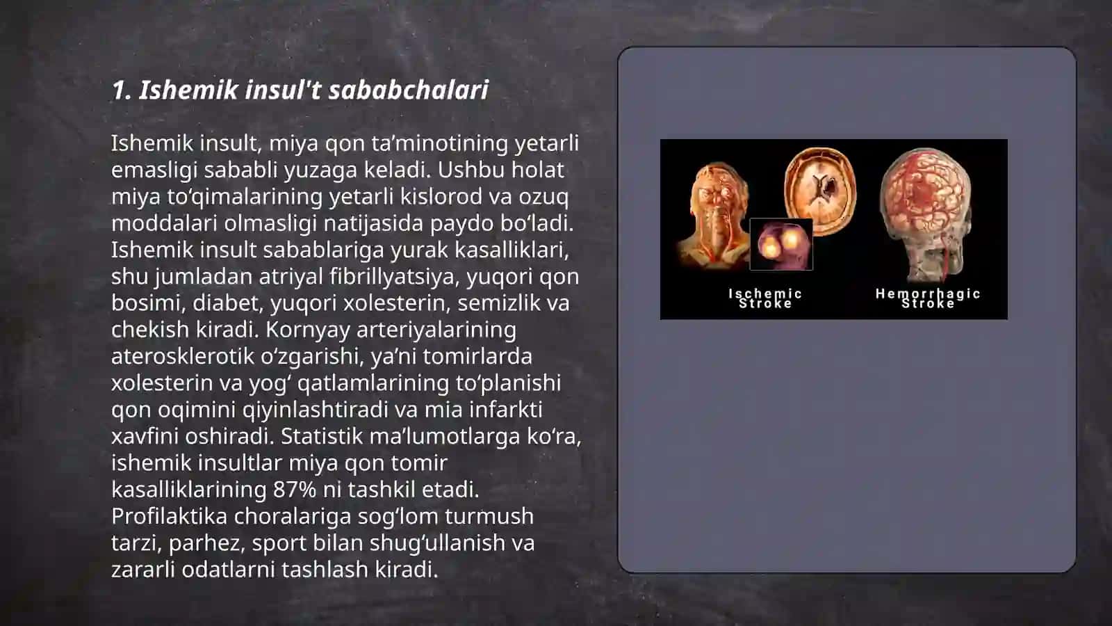 Ishemik insul't sababchalari 3
