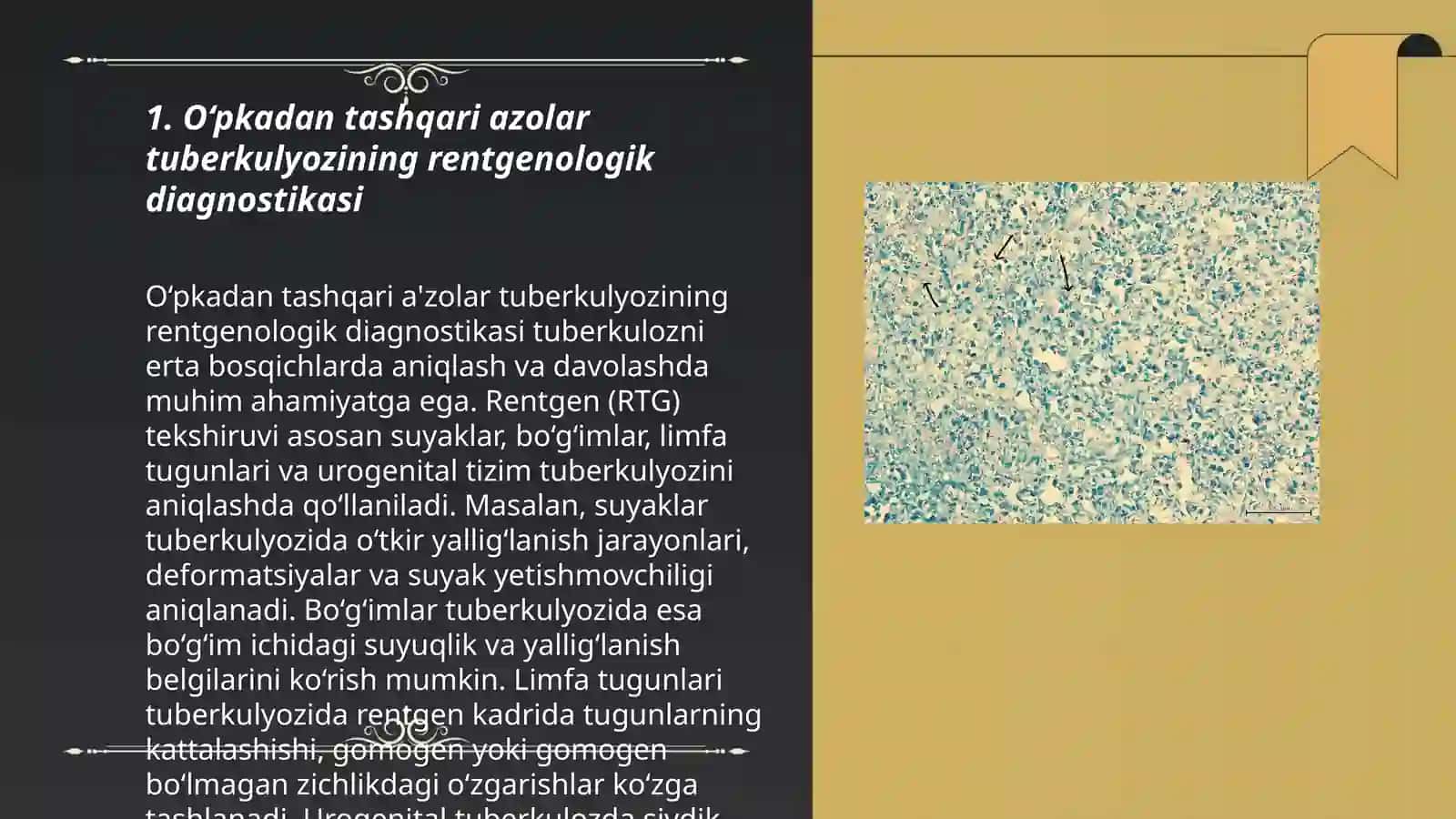 O'pkadan tashqari azolar tuberkulyozining rentgenologik va nur diagnostikasi 3