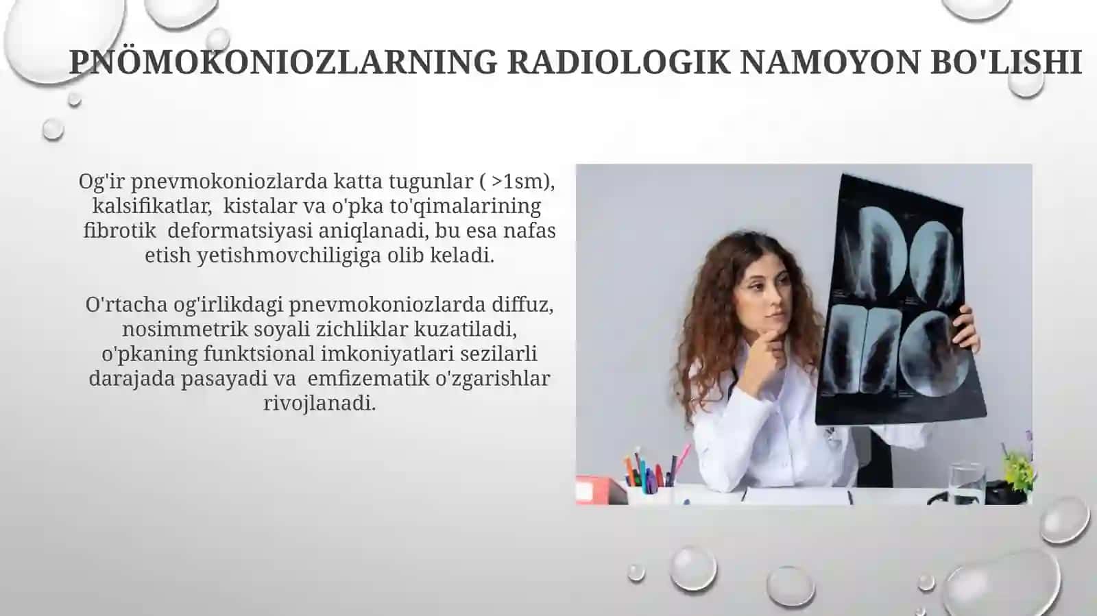 Nafas olish tizimi kasalliklarida turlirentgenologiksindromlar 3