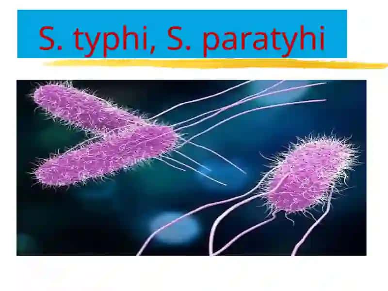 Ич терлама –қорин тифи (typhus abdominalis)Qorintifi,AvaVparatiflarnisalmonellachaqiradi 3