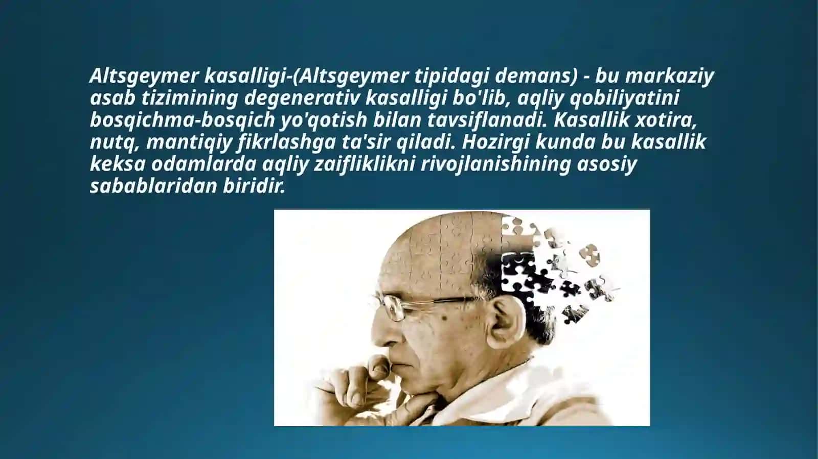 Alstgeymer kasalligi 3