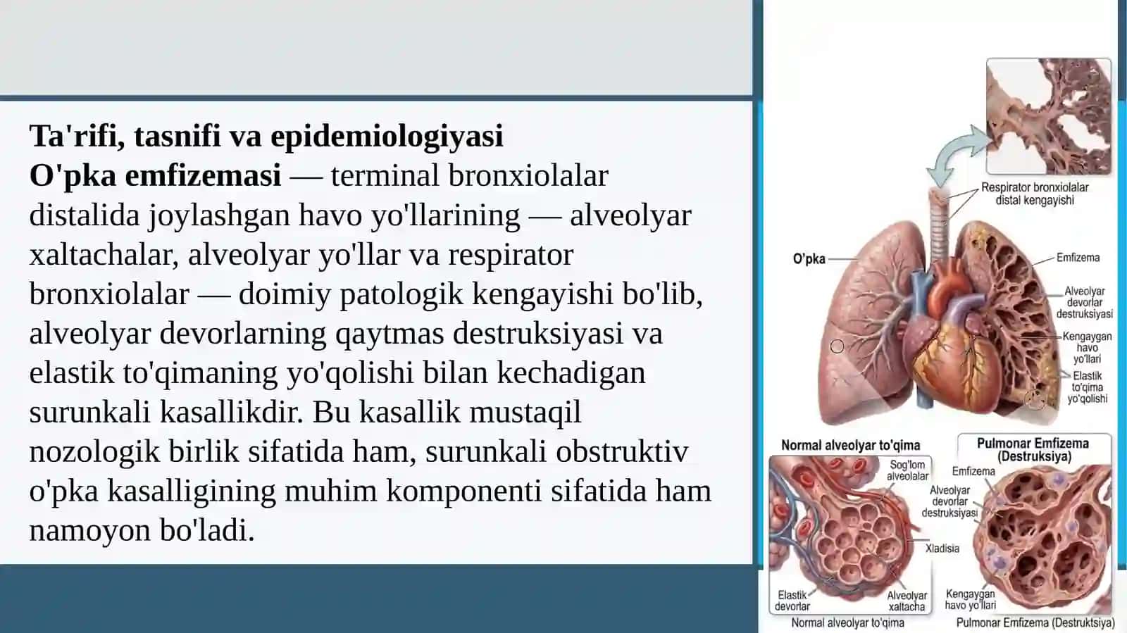 O’PKA EMFIZEMASI PREZENTATSIYA 3