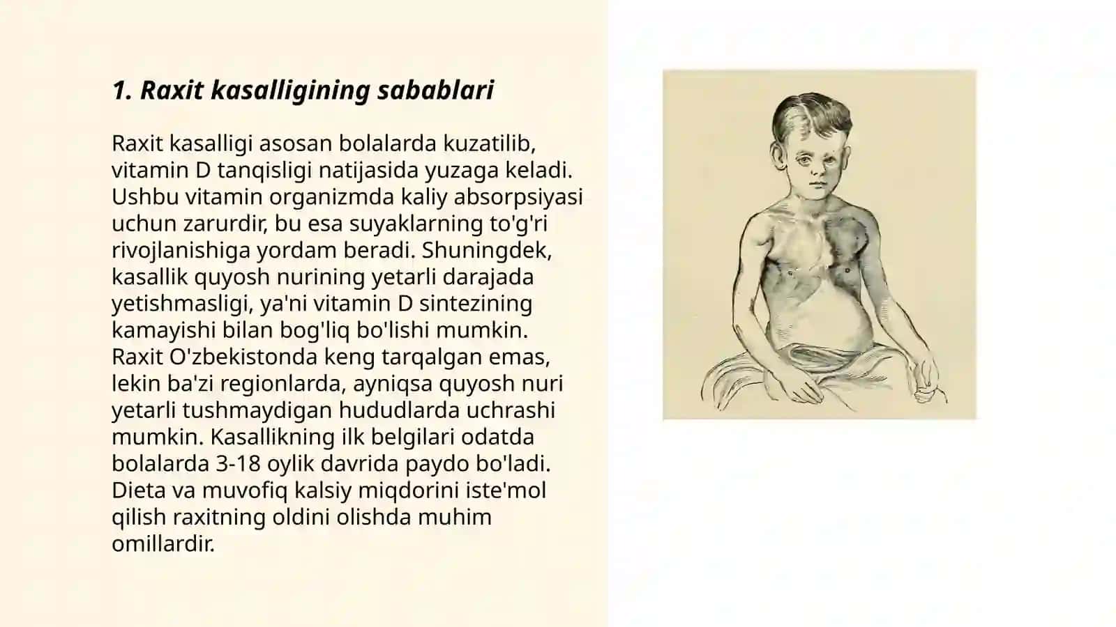 Raxit kasalligi 3