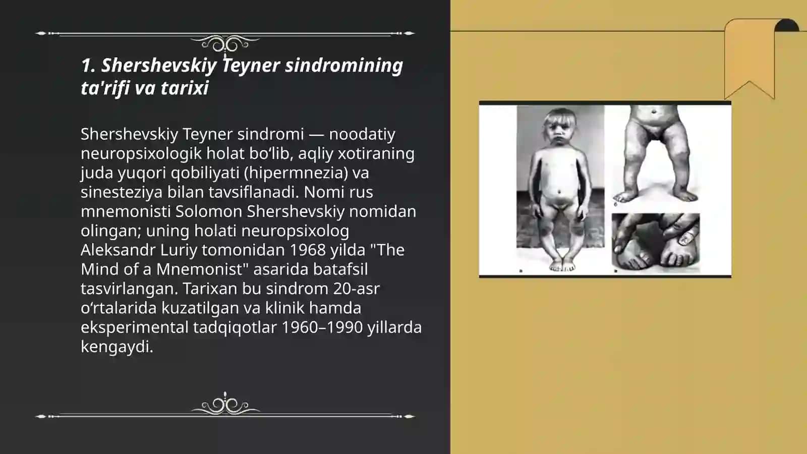 Shershevskiy Teyner sindromi 3