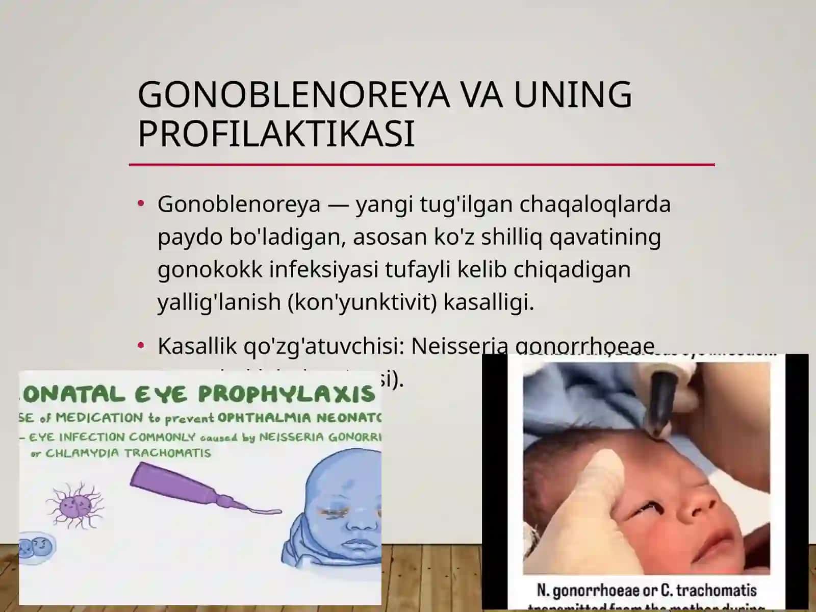 Qiz bolalar so‘zagi. Gonoblenoreya va uning profilaktikasi, gonokokkli proktit. Bakterial vagino 3