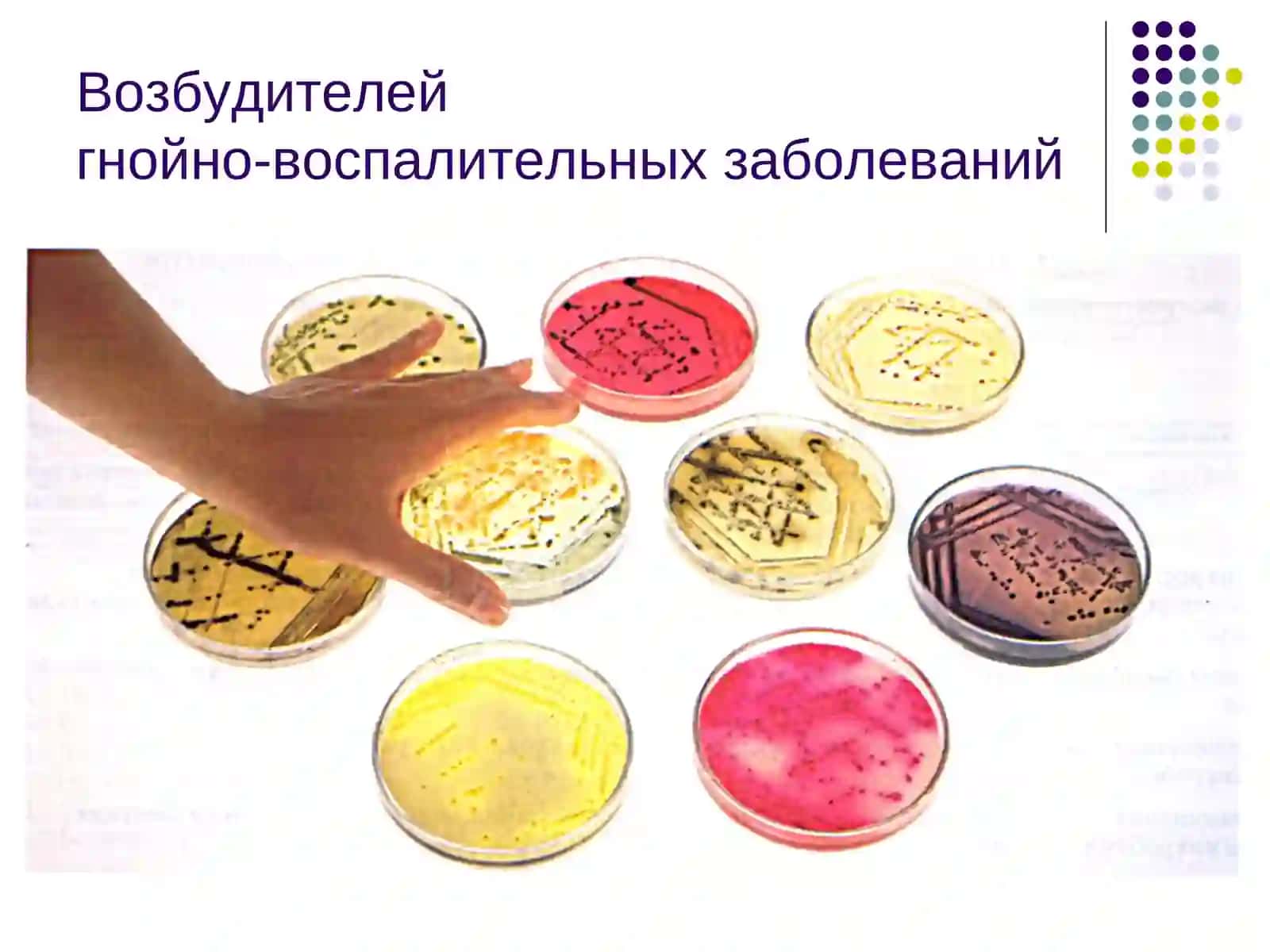 Характеристика возбудителей гнойно-воспалительных заболеваний 3