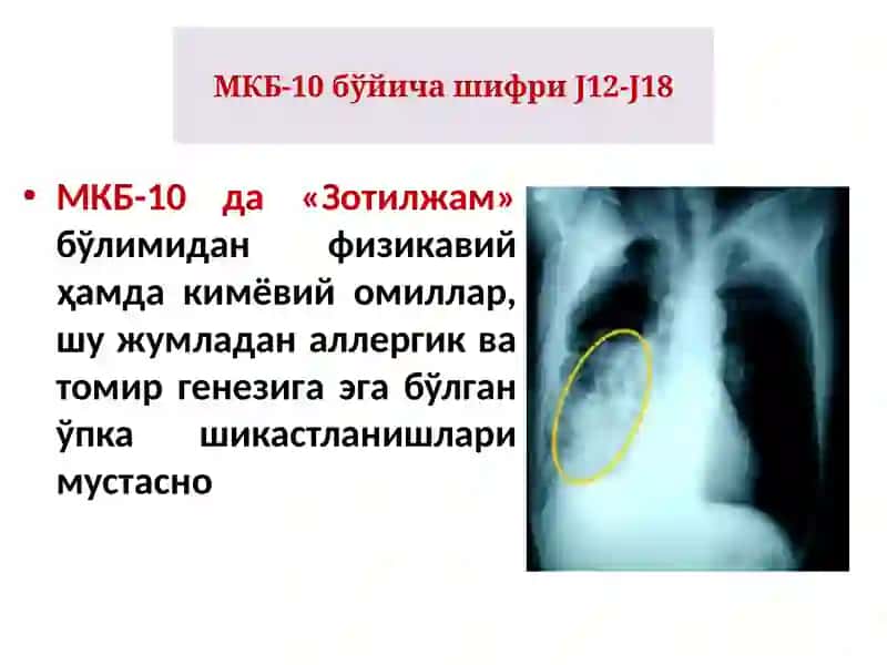 Зотилжам 3