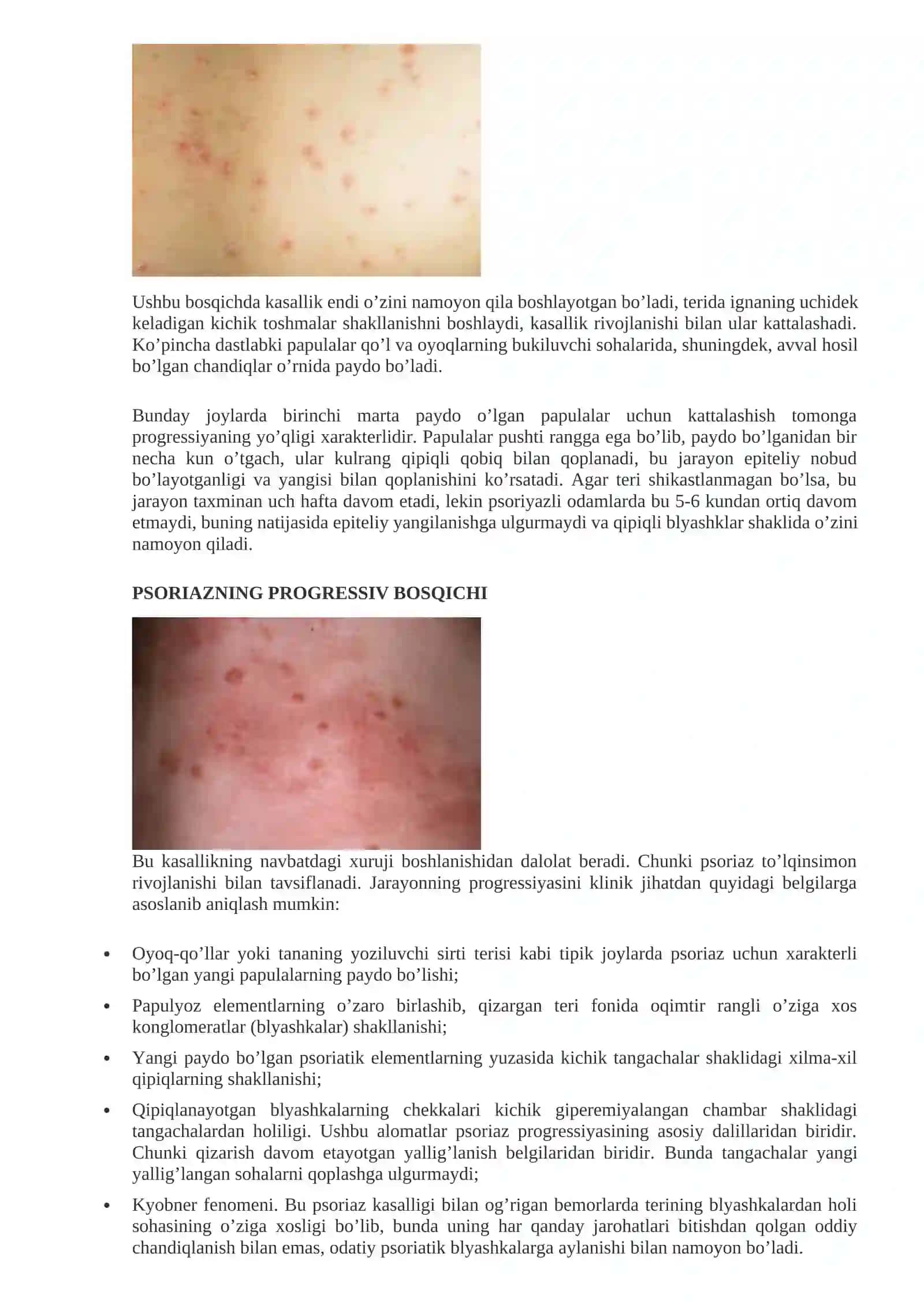 PSORIAZ 3